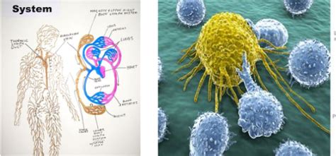 burkins lymphoma